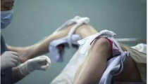 女同学做完人流后妇科病经常复发
